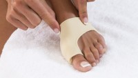 Bunions, Foot Problems (General), Pain